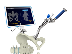 Computer-assisted Hip Replacement