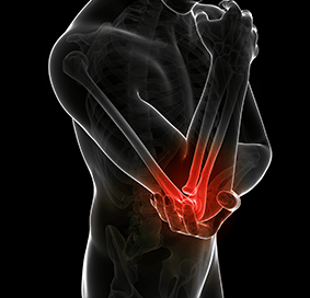 Mid-shaft Humerus Fracture